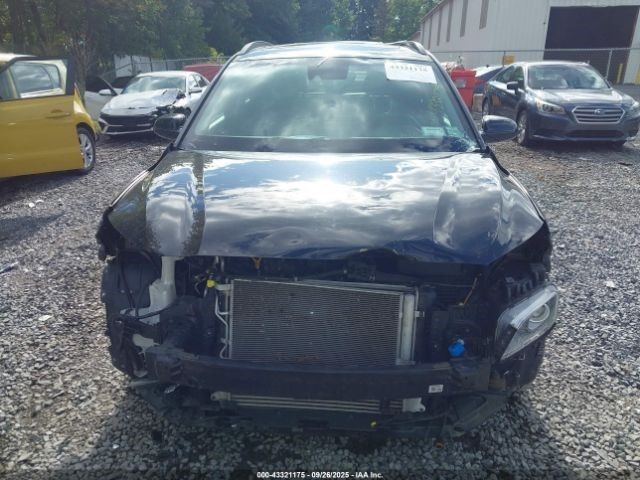 Audio Equipment Radio Display And Receiver US Market Fits 18-21 KONA 1268763